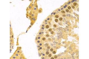 Immunohistochemistry of paraffin-embedded Rat testis using RFC4 Polyclonal Antibody at dilution of 1:100 (40x lens). (RFC4 抗体)