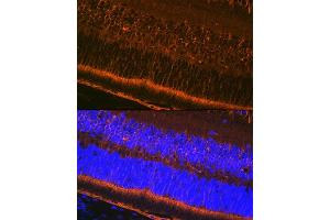 Immunofluorescence analysis of mouse eye using CRALBP Rabbit mAb (ABIN7269934) at dilution of 1:100 (40x lens). (RLBP1 抗体)