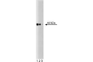 Western Blotting (WB) image for anti-Heat Shock 60kDa Protein 1 (Chaperonin) (HSPD1) antibody (ABIN968591) (HSPD1 抗体)