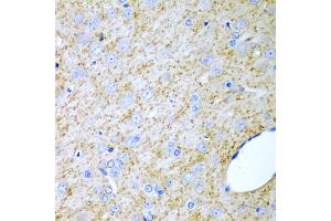 Immunohistochemistry of paraffin-embedded rat brain using INHA antibody. (Inhibin alpha 抗体)