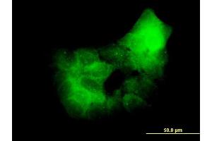 Immunofluorescence of monoclonal antibody to PRKCD on A-431 cell.