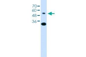 Western blot analysis of Jurkat cell lysate with SLC2A5 polyclonal antibody . (SLC2A5 抗体  (AA 300-349))