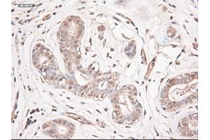 Immunohistochemical staining of paraffin-embedded breast using anti-NTF3 (ABIN2452548) mouse monoclonal antibody. (Neurotrophin 3 抗体  (AA 139-257))