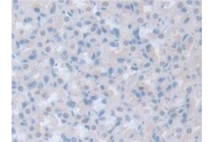 Detection of ITSN1 in Rat Stomach Tissue using Polyclonal Antibody to Intersectin 1 (ITSN1) (ITSN1 抗体  (AA 1-227))