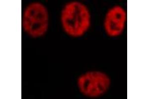 ABIN6274338 staining Hela cells by IF/ICC. (TCOF1 抗体  (N-Term))