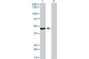 Image no. 4 for anti-ATPase, H+ Transporting, Lysosomal 38kDa, V0 Subunit D1 (ATP6V0D1) (AA 238-309) antibody (ABIN465977) (ATP6V0D1 抗体  (AA 238-309))