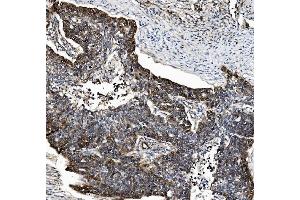 IHC analysis of PSMB5/MB1 using anti-PSMB5/MB1 antibody (ABIN7599183).