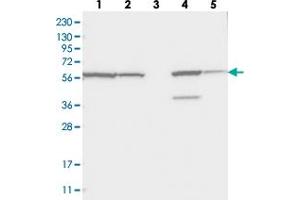 Western blot analysis of Lane 1: RT-4, Lane 2: U-251 MG, Lane 3: Human Plasma, Lane 4: Liver, Lane 5: Tonsil with ZNF354C polyclonal antibody  at 1:250-1:500 dilution. (ZNF354C 抗体)