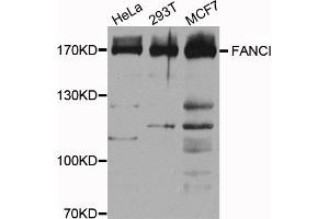 Western blot analysis of extracts of various cell lines, using FANCI antibody. (FANCI 抗体)