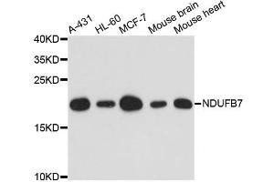 Western blot analysis of extracts of various cell lines, using NDUFB7 antibody. (NDUFB7 抗体)