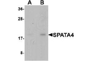 Western blot analysis of SPATA4 in mouse stomach tissue lysate with SPATA4 Antibody  at (A) 1 and (B) 2 μg/mL (SPATA4 抗体  (C-Term))