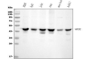 Western blot analysis of MEK2/MAP2K2 using anti-MEK2/MAP2K2 antibody (ABIN7599356).
