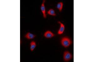 Immunofluorescent analysis of IKB epsilon (pS22) staining in HeLa cells.