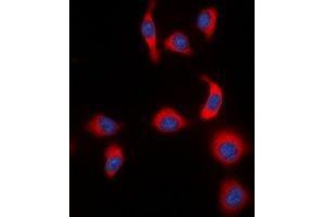 Immunofluorescent analysis of IKB epsilon (pS22) staining in HeLa cells. (NFKBIE 抗体  (pSer22))