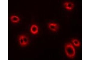 Immunofluorescent analysis of HLA-A staining in U2OS cells. (HLA-A 抗体)
