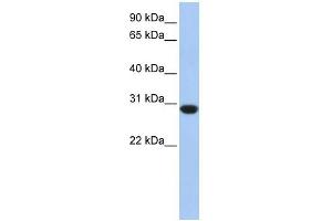 ASB12 antibody used at 1 ug/ml to detect target protein. (ASB12 抗体  (C-Term))