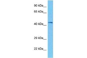 Host:  Mouse  Target Name:  PHKG2  Sample Tissue:  Mouse Kidney  Antibody Dilution:  1ug/ml (PHKG2 抗体  (N-Term))