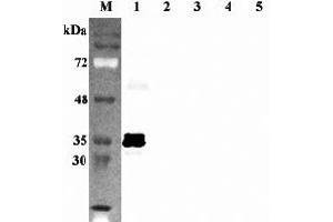 Western blot analysis using anti-Sirtuin 5 (human), pAb  at 1:2'000 dilution. (SIRT5 抗体)