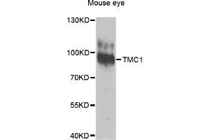 Western blot analysis of extracts of Mouse eye cells, using TMC1 antibody.