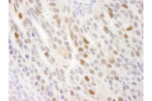 anti-Kinesin Family Member C1 (KIFC1) (AA 625-673) antibody