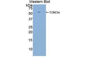 Western Blotting (WB) image for anti-Complement Component (3d/Epstein Barr Virus) Receptor 2 (CR2) (AA 729-957) antibody (ABIN1858487) (CD21 抗体  (AA 729-957))