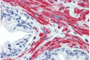 Human Prostate: Formalin-Fixed, Paraffin-Embedded (FFPE) (beta Actin 抗体  (AA 359-368))