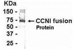 Western Blotting (WB) image for anti-Cyclin I (CCNI) (AA 211-377) antibody (ABIN2468095) (Cyclin I 抗体  (AA 211-377))