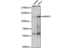 Western blot analysis of extracts of various cell lines, using RBM12 antibody (ABIN7270079) at 1:1000 dilution. (RBM12 抗体  (C-Term))