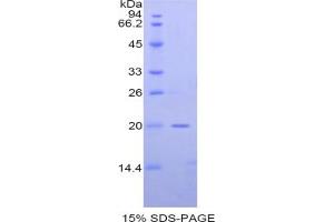 SDS-PAGE analysis of Mouse NAGase Protein.