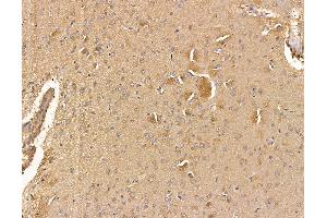 ABIN6265053 and ABIN6279817 at 1/100 staining rat brain tissue by IHC-P.