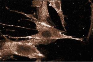Immunofluorescence staining of WI-38 cells (Human lung fibroblasts, ATCC CCL-75). (BAD 抗体  (AA 39-198))