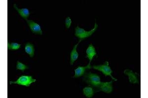 Immunofluorescence staining of U251 cells with ABIN7165606 at 1:100, counter-stained with DAPI. (FRY-Like 抗体  (AA 42-739))