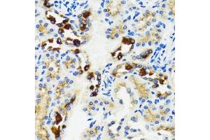 Immunohistochemistry of paraffin-embedded rat kidney using GABARAP antibody.