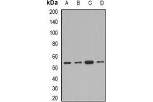 Western blot analysis of AEBP2 expression in Jurkat (A), A549 (B), mouse kidney (C), rat heart (D) whole cell lysates. (AEBP2 抗体)
