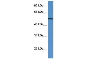 Western Blot showing GC antibody used at a concentration of 1 ug/ml against Placenta Lysate (Gc (N-Term) 抗体)