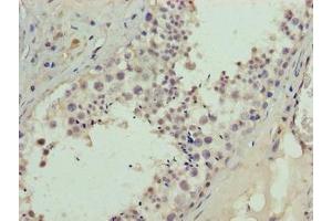 Immunohistochemistry of paraffin-embedded human testis tissue using ABIN7145267 at dilution of 1:100 (BATF2 抗体  (AA 1-189))