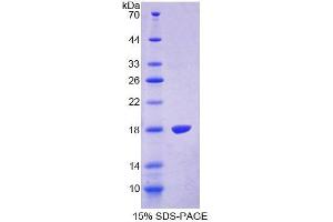 SDS-PAGE analysis of Human TRPV3 Protein. (TRPV3 蛋白)