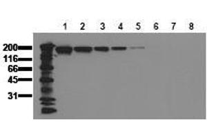 Western Blotting (WB) image for anti-Epidermal Growth Factor Receptor (EGFR) (AA 960-980) antibody (ABIN126763) (EGFR 抗体  (AA 960-980))
