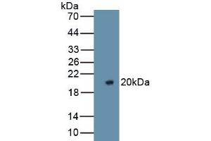 Detection of Recombinant F5, Rat using Polyclonal Antibody to Coagulation Factor V (F5) (Coagulation Factor V 抗体  (AA 1944-2099))