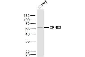 Mouse kidney lysates probed with CPNE2 Polyclonal Antibody, Unconjugated  at 1:300 dilution and 4˚C overnight incubation.