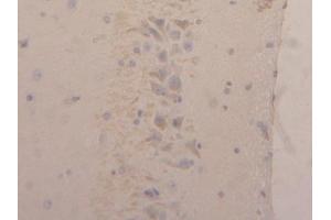 Detection of NGAL in Rat Brain Tissue using Polyclonal Antibody to Neutrophil gelatinase-associated lipocalin (NGAL) (Lipocalin 2 抗体  (AA 21-198))