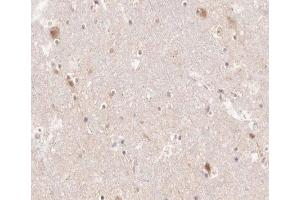 ABIN6266518 at 1/200 staining human brain tissue sections by IHC-P. (PTGS1 抗体  (C-Term))