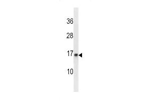 PO Antibody (C-term) (ABIN1881673 and ABIN2843330) western blot analysis in WiDr cell line lysates (35 μg/lane). (POMP 抗体  (C-Term))