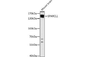 Western blot analysis of extracts of Mouse brain, using SP antibody (ABIN7270512) at 1:1000 dilution. (SPARCL1 抗体  (AA 17-300))