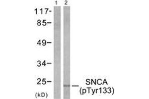 Western blot analysis of extracts from 293 cells treated with Etoposide 25 muM 60', using Synuclein-alpha (Phospho-Tyr133) Antibody. (SNCA 抗体  (pTyr133))