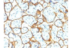 Formalin-fixed, paraffin-embedded human Placenta stained with Insulin Receptor Rabbit Recombinant Monoclonal Antibody (INSR/2277R). (Recombinant Insulin Receptor 抗体  (Extracellular Domain))
