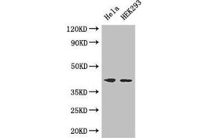 Western Blot Positive WB detected in: Hela whole cell lysate, HEK293 whole cell lysate All lanes: ACTG1 antibody at 3 μg/mL Secondary Goat polyclonal to rabbit IgG at 1/50000 dilution Predicted band size: 42 kDa Observed band size: 42 kDa (Actin, gamma 1 抗体  (AA 13-166))