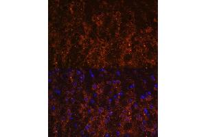 Immunofluorescence analysis of mouse brain using SNX13 antibody (ABIN6129554, ABIN6148236, ABIN6148237 and ABIN6216585) at dilution of 1:100. (SNX13 抗体  (AA 50-230))
