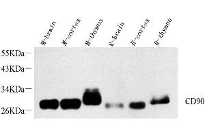 Western Blot analysis of various samples using THY1 Polyclonal Antibody at dilution of 1:1000. (CD90 抗体)