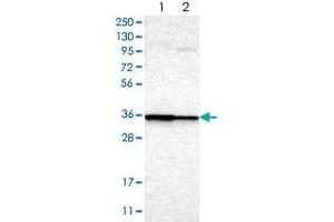 Western blot analysis of Lane 1: RT-4, Lane 2: U-251MG sp with LAX1 polyclonal antibody  at 1:100-1:250 dilution. (LAX1 抗体)